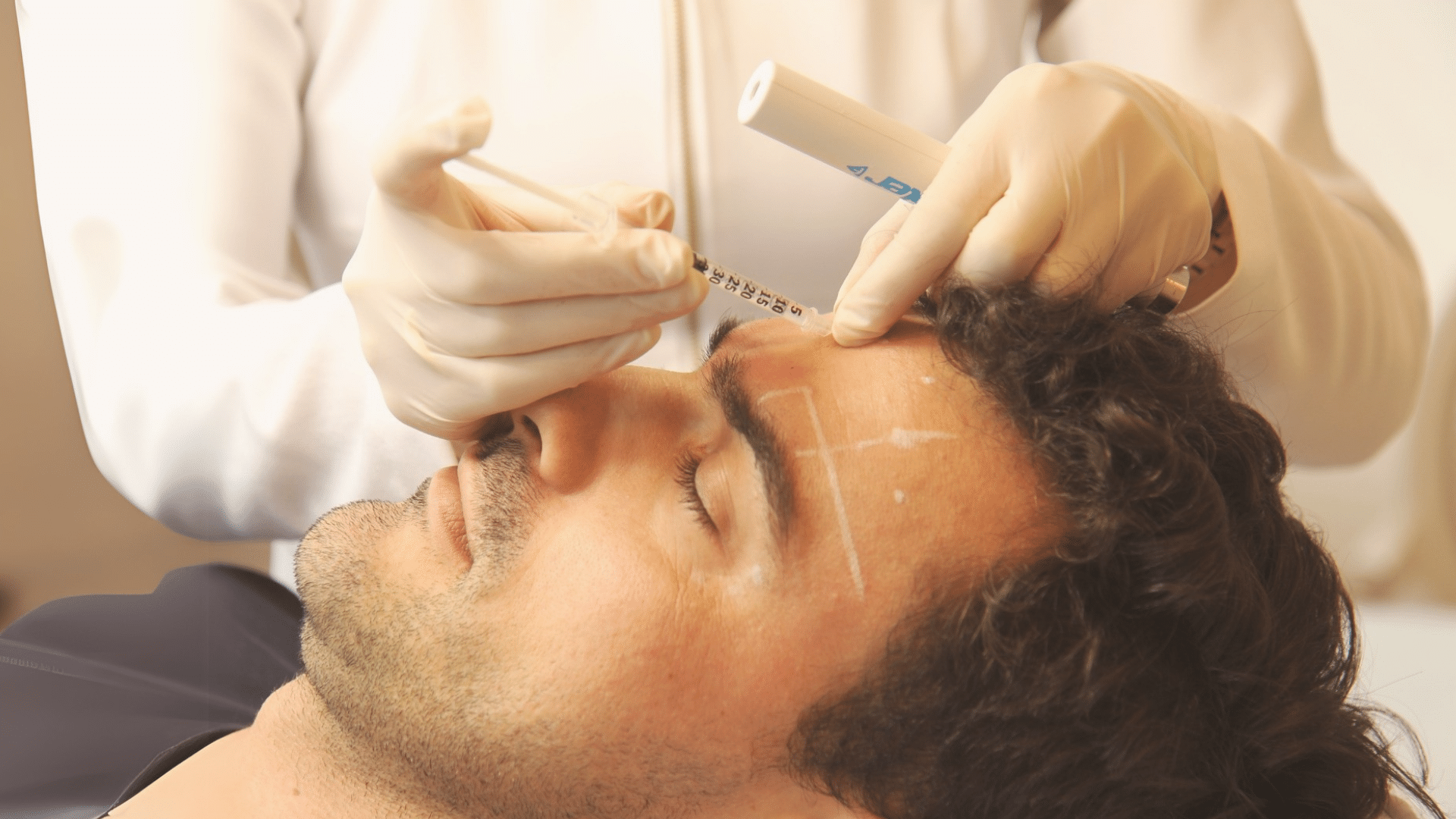 estética facial masculina