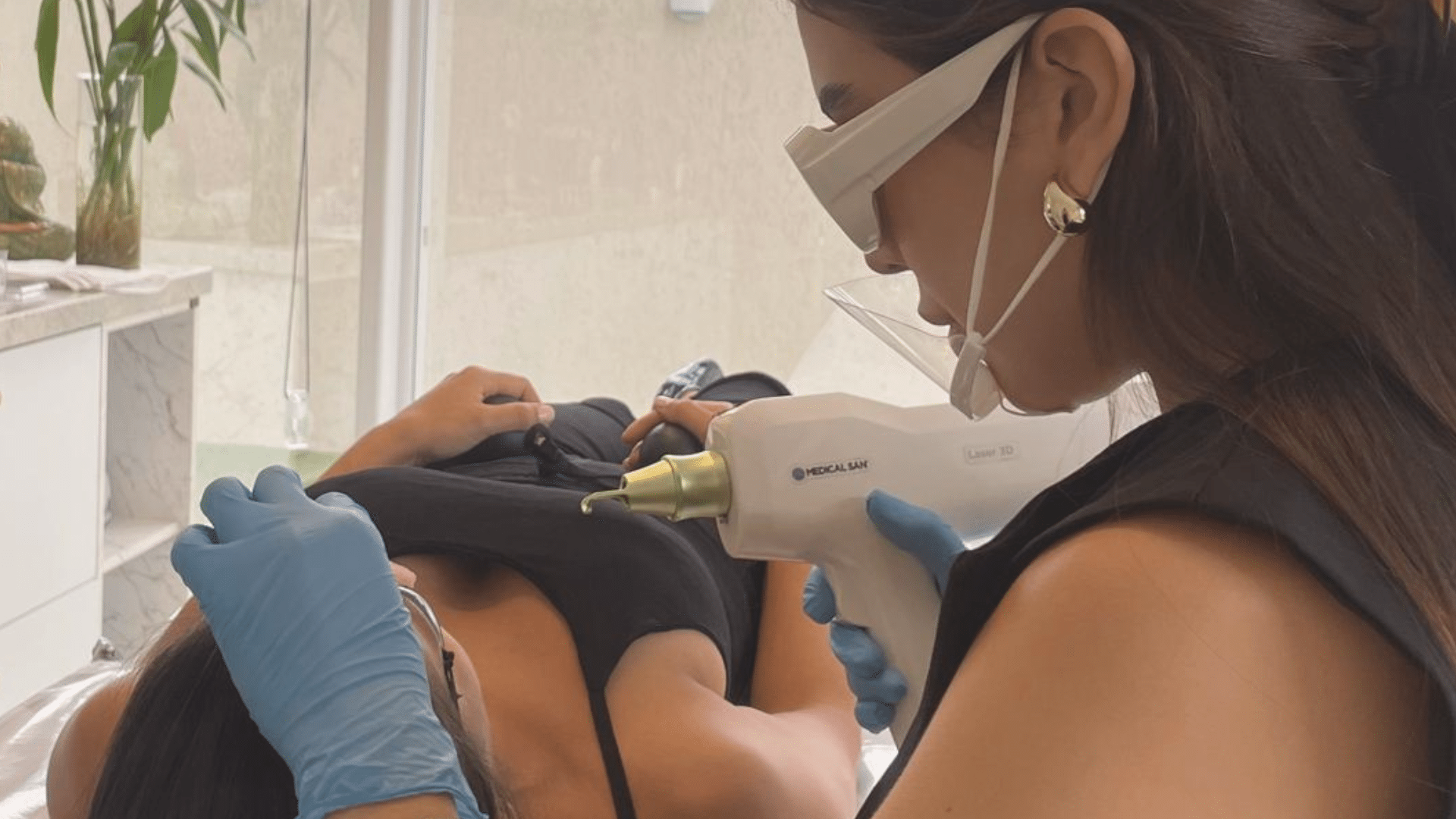 remoção de micropigmentação de sobrancelha a laser