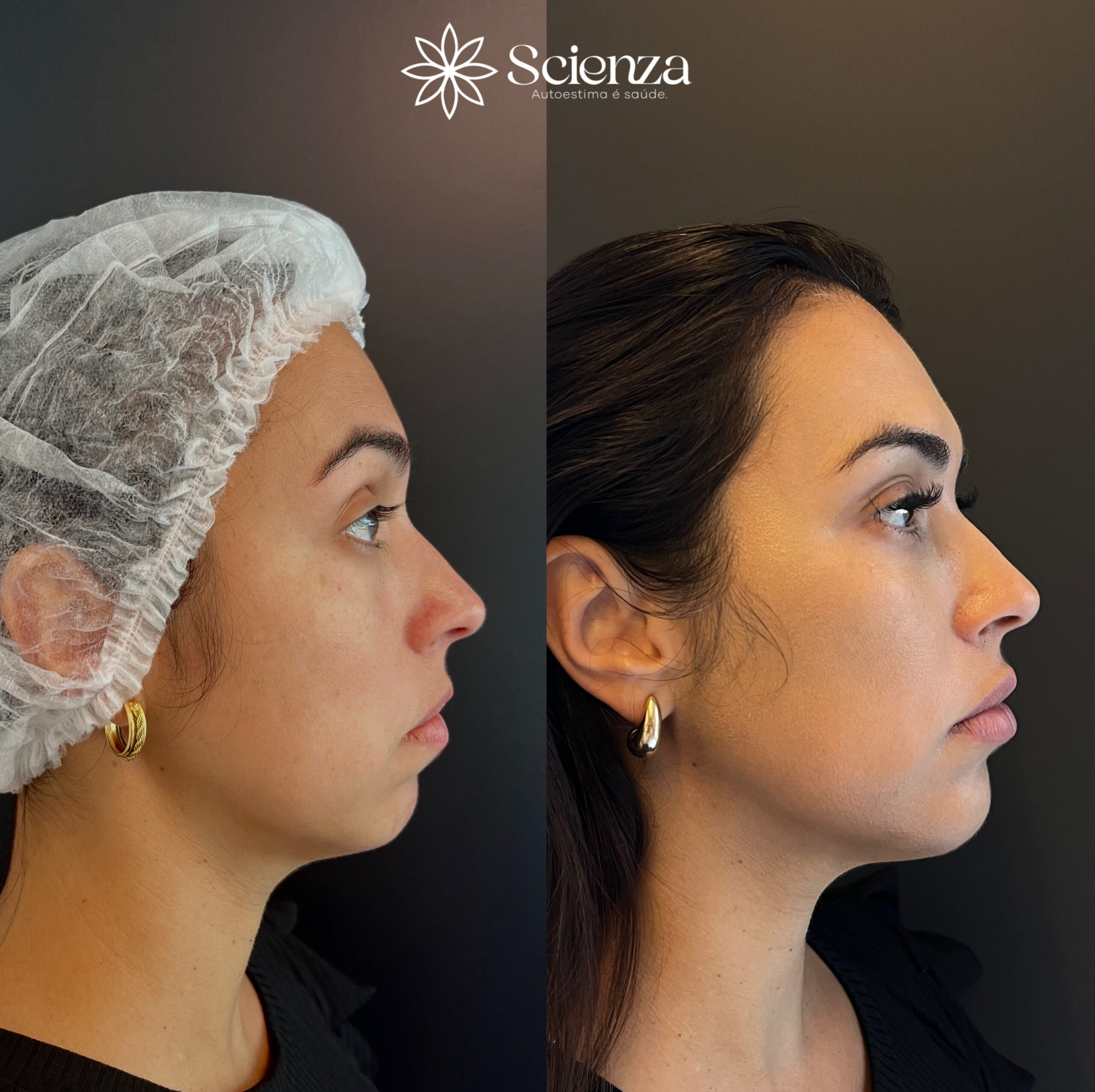 Card Preenchimentos faciais (1)