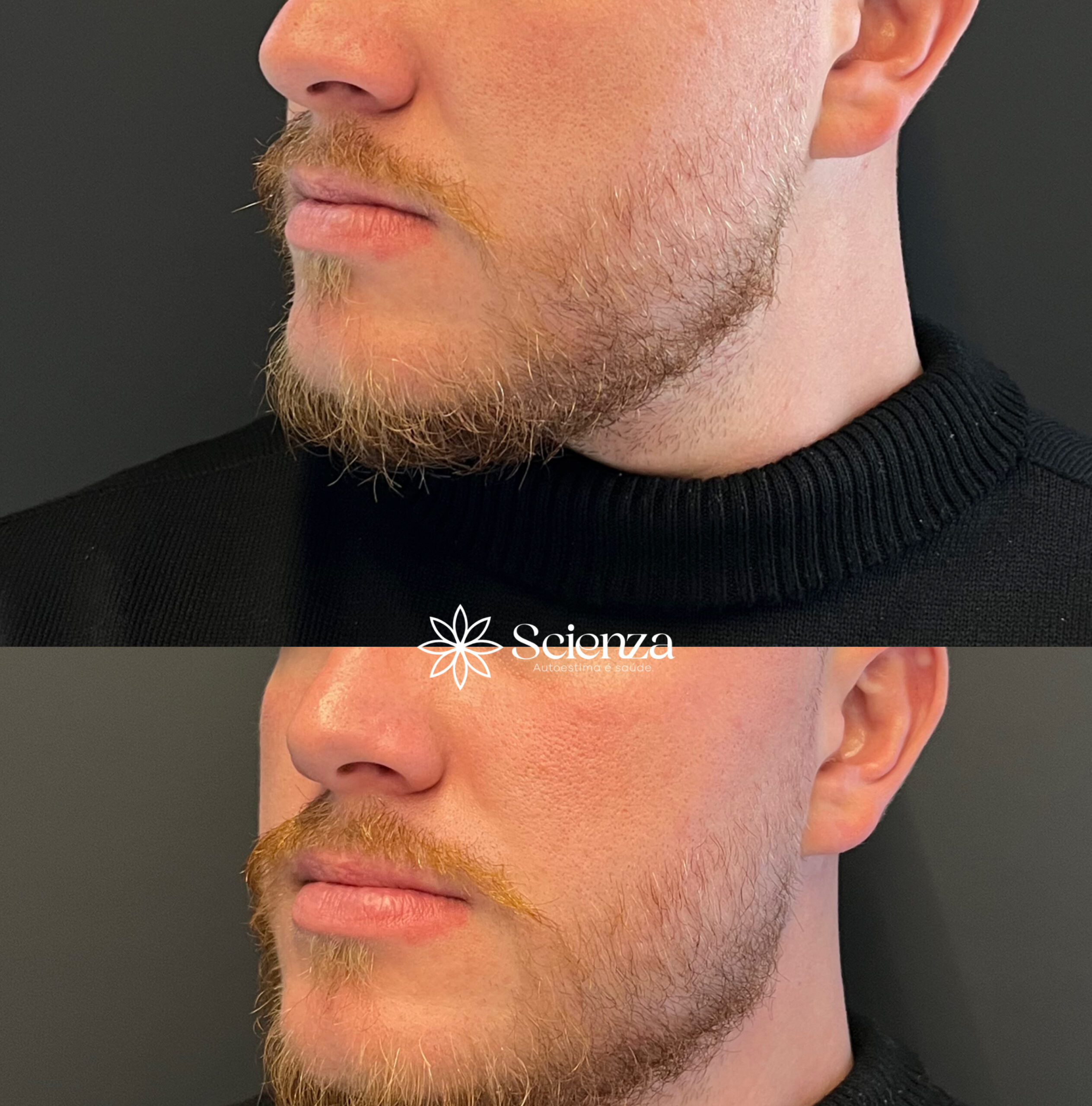 Card contorno facial 2 (1)