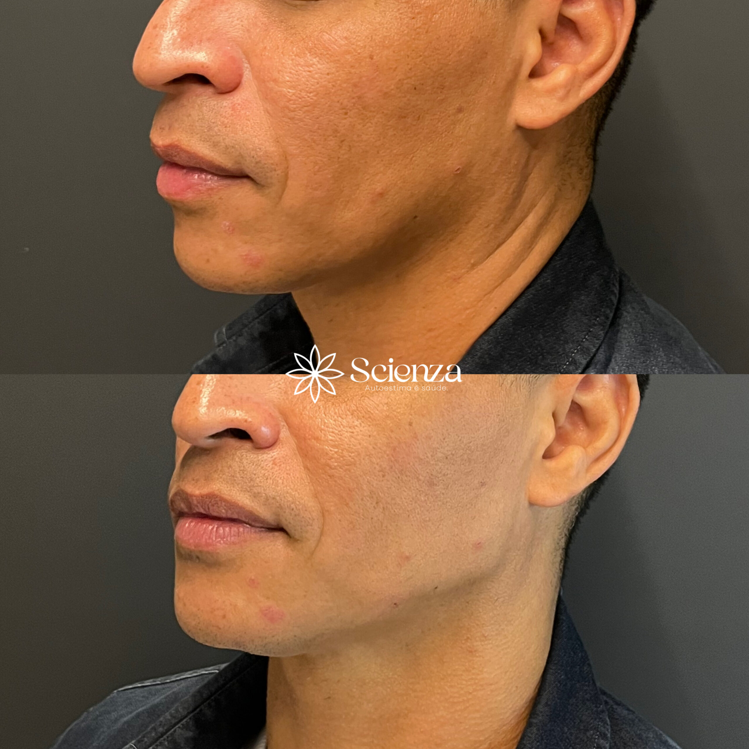 Card contorno facial