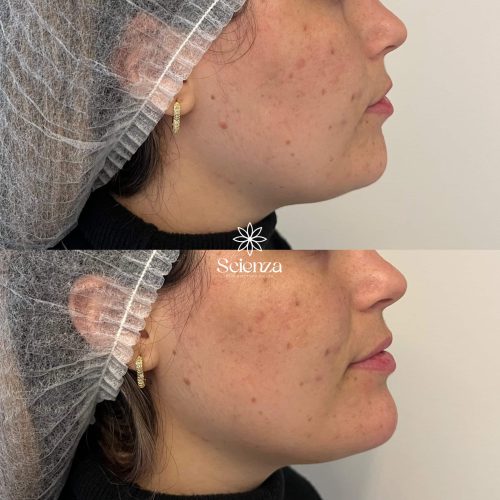 62B2A7AA-D1CE-4067-849A-8E2A7EB19290