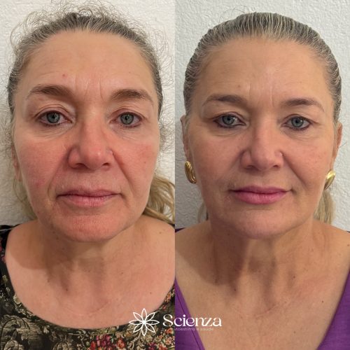 Card harmonização facial 2 (1)