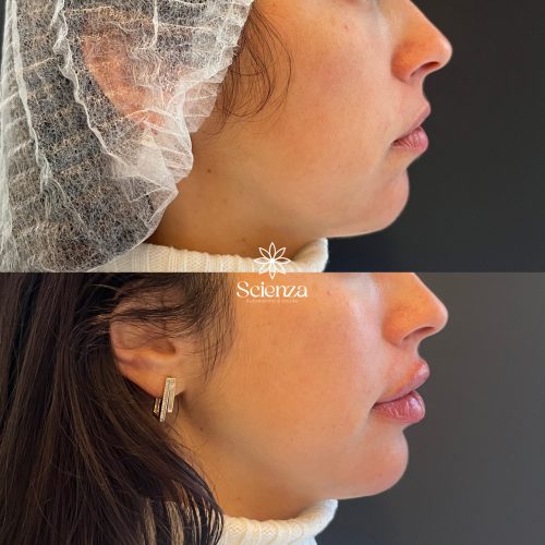 E65717CF-0109-457A-91F1-0DDBDCC6A1B9