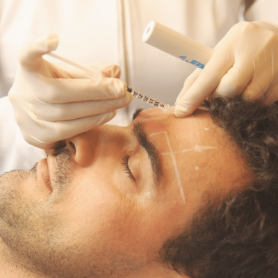 estética facial masculina